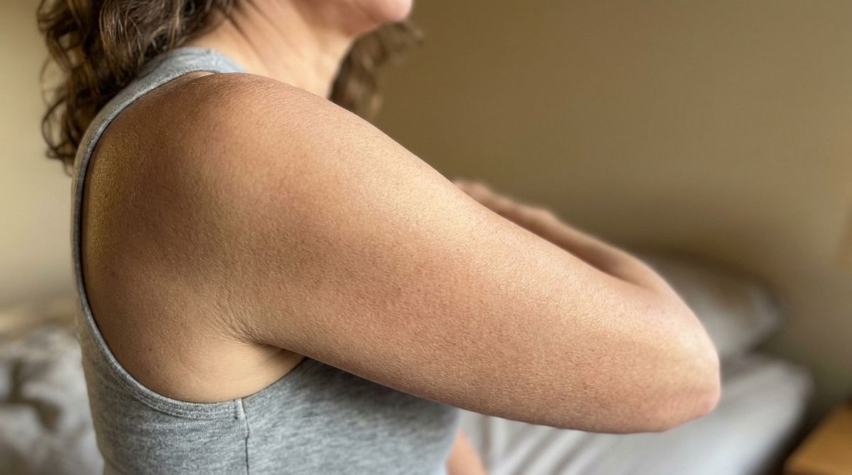 [IMAGE PROMPT — Supporting Image]: "Close-up of smooth, healthy-looking skin texture on an arm and shoulder, soft natura